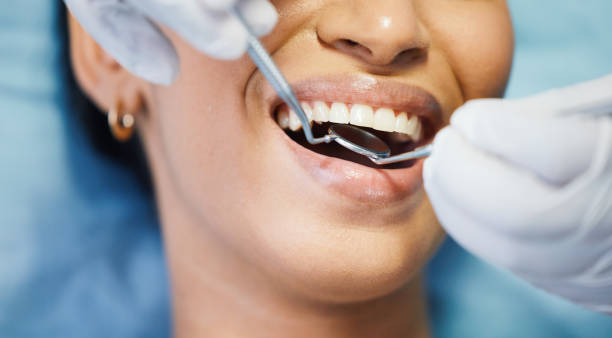 Best Emergency Broken Tooth Repair in Naval Academy, MD