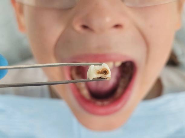 Best Weekend Emergency Dentist in Naval Academy, MD